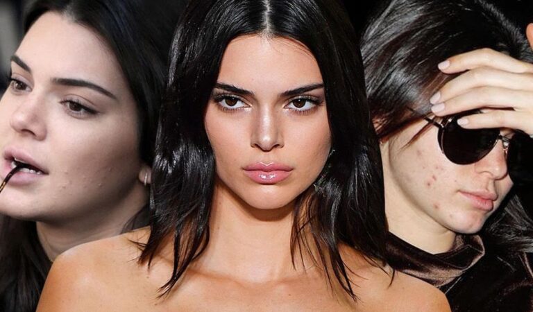 Kendall Jenner se emborracha y rompe en llanto al hablar de su acné [Video]