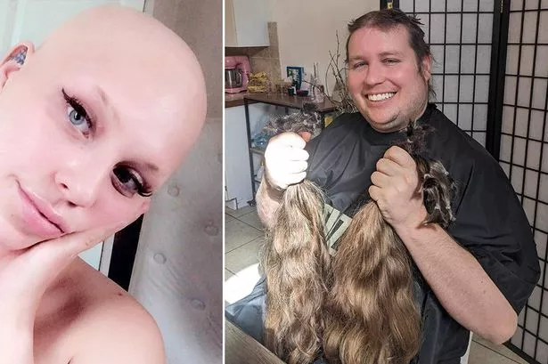 ¡El amor sí existe! Este chico dejó crecer su cabello para regalarle una peluca a su novia que padece alopecia